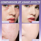 🏖️Summer Hot Sale 50% OFF🌞Matte Concealer for Face & Body