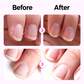 🌟BUY 1 GET 2 FREE🌟2025 New Upgraded 3-in-1 Nail Care Pen💅